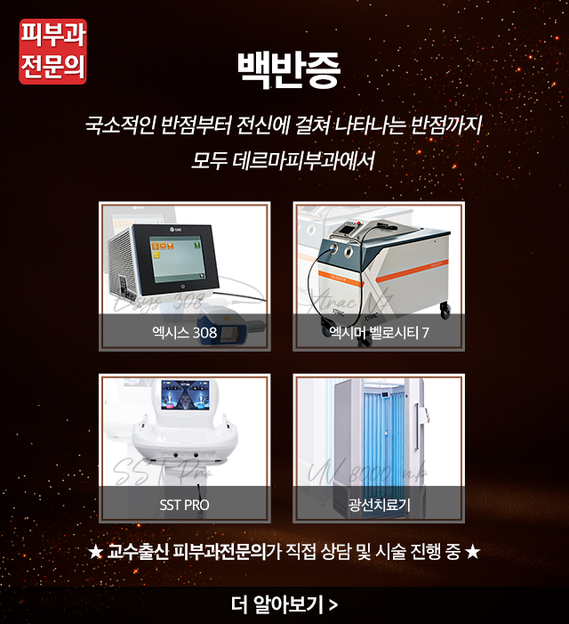 백반증