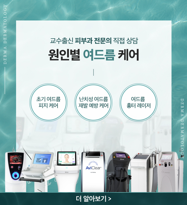 원인별 여드름 케어