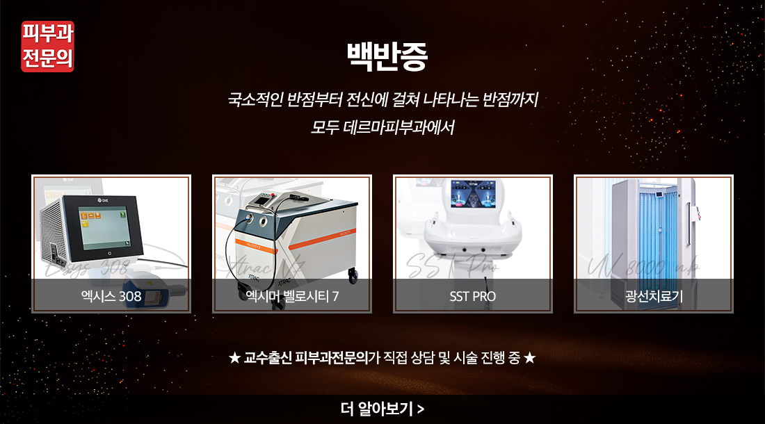백반증
