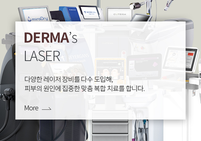 laser