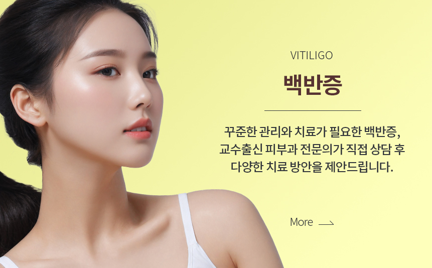 백반증