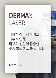 laser