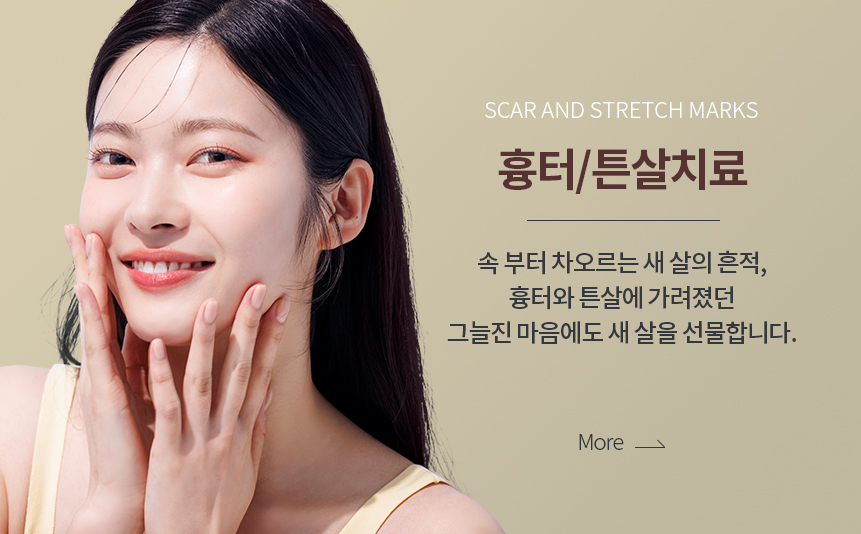 흉터/튼살