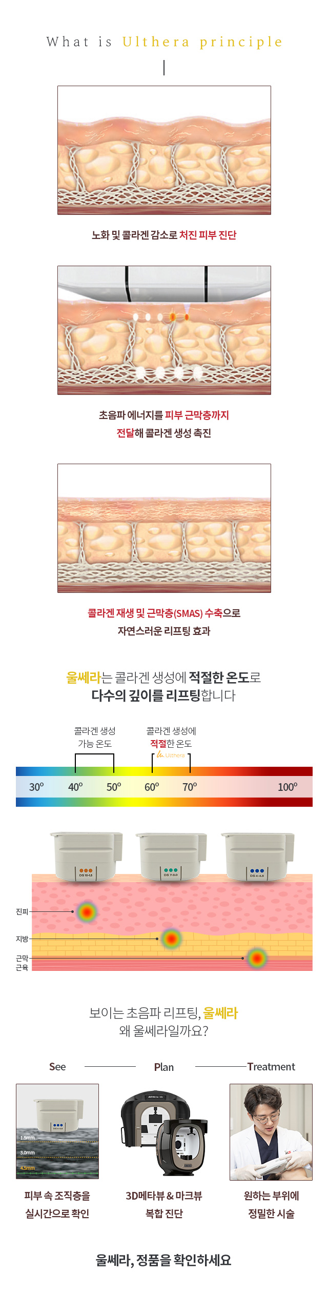 울쎄라