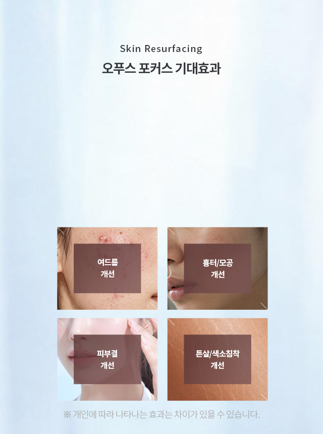 오푸스 포커스