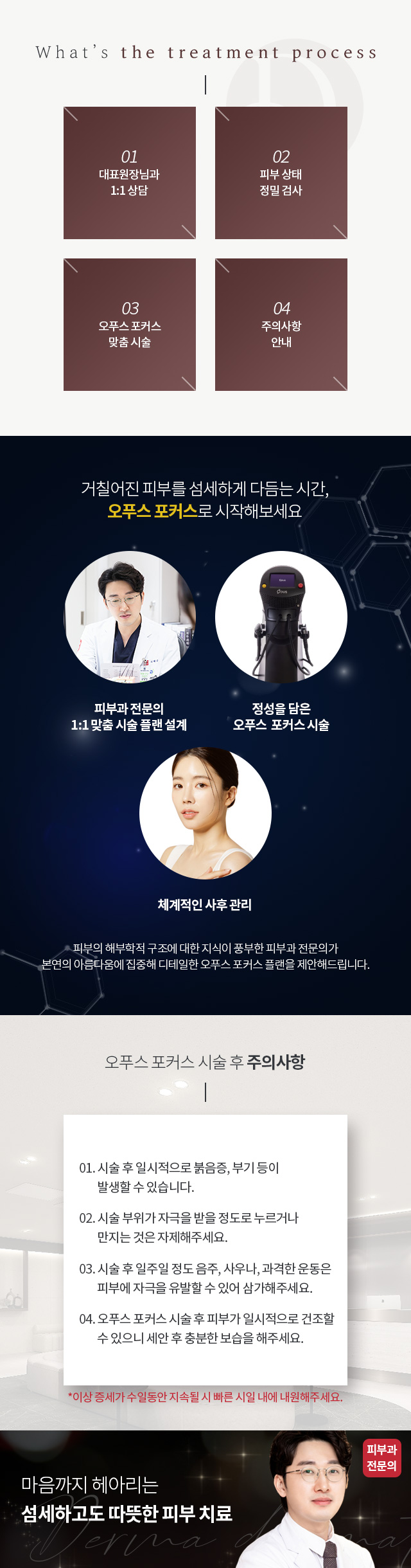 오푸스 포커스